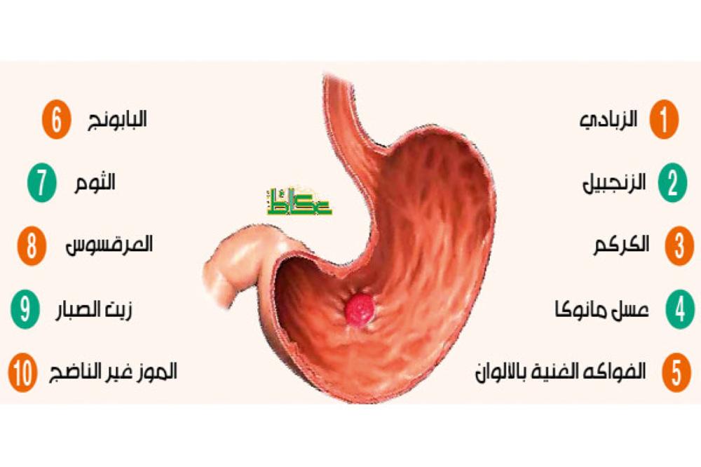 اعراض ثقب المعدة - اسباب وعلاج قرحة المعدة Unnamed File 22