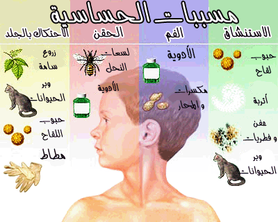 اعراض حساسية الدم , انتبه حساسية الدم قد تؤدي الي الوفاة عند ظهور هذه الاعراض