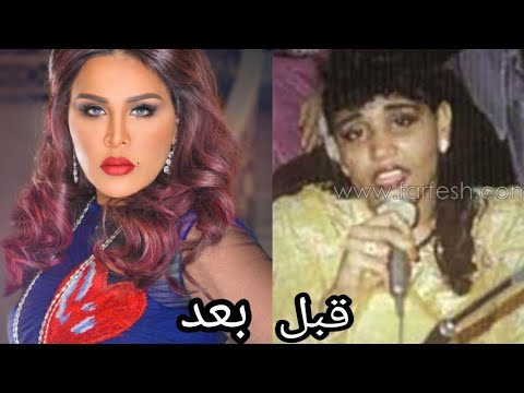 احلام قبل وبعد - شاهد الفنانه قبل و بعد التجميل 853 1