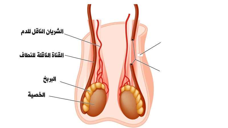 الم الخصية اليسرى المفاجئ , اصابنى الم مفاجئ فهل يؤثر على العلاقه