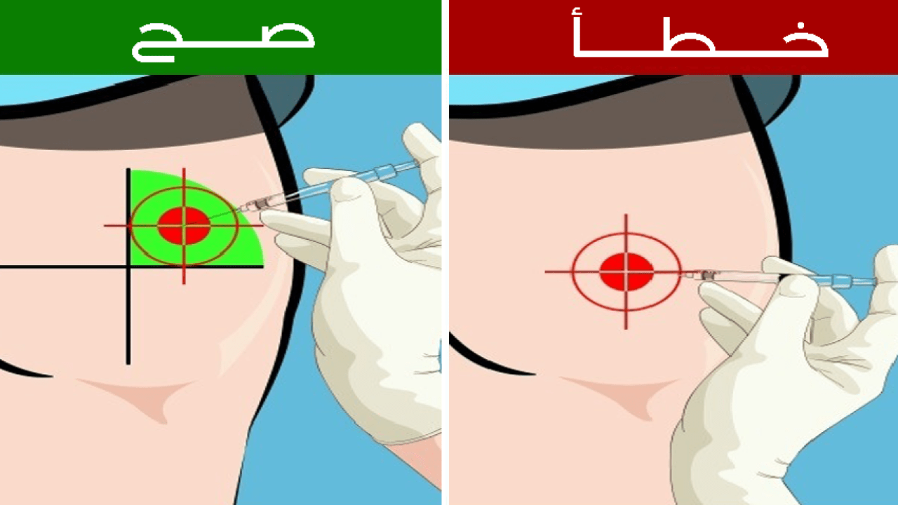 كيف اعطى حقنة عضل , الطريقه الصحيحه لاعطاء حقنه فى العضل