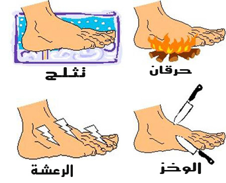 الام اسفل القدم , ازاي نقدر نتعامل مع الام اسفل القدم