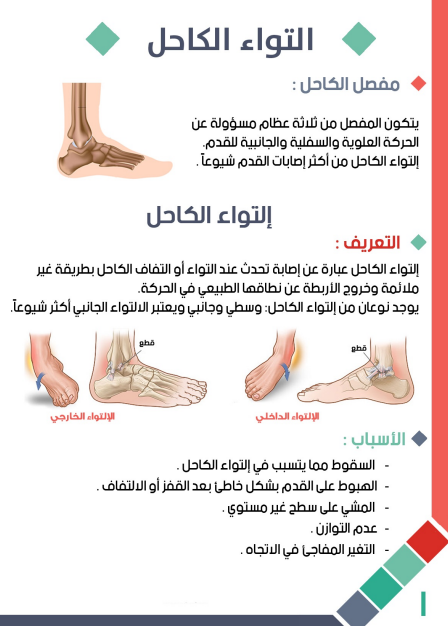 الم الكاحل عند المشي-اسباب الام الكاحل وارشادات يجب اتباعها عند تلقي العلاج 6432 1