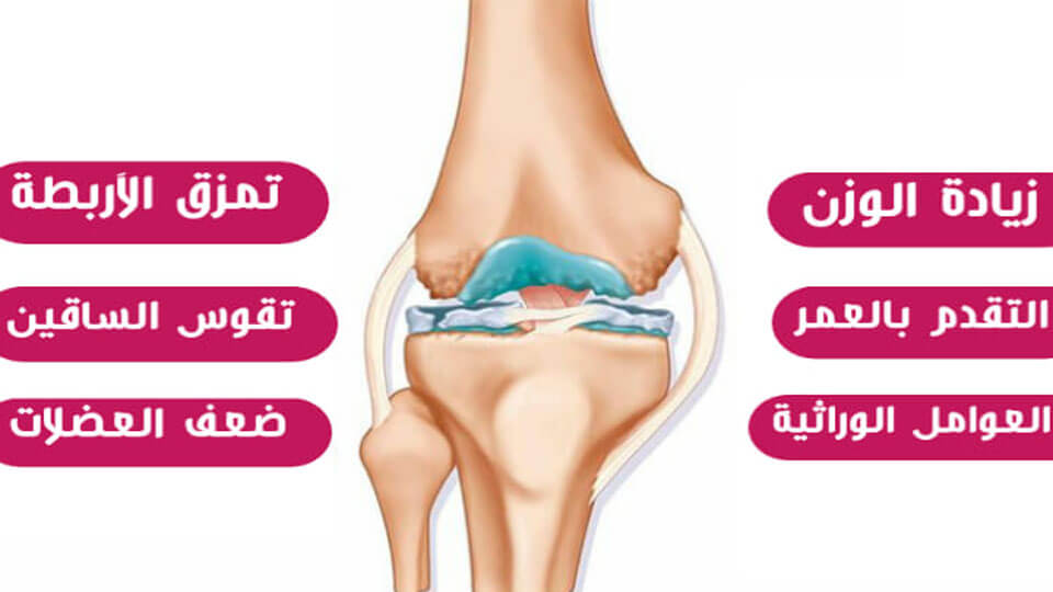 اسباب الم الركبة اليمنى - اعرف سبب الم ركبتك وعلاجها 3986