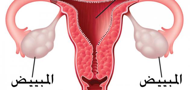 علاج ضيق عنق الرحم بالاعشاب , ما لا تعرفيه عن ضيق عنق الرحم