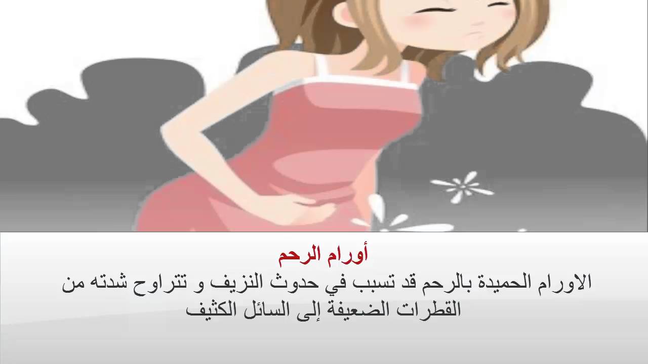 نزول دم ايام التبويض , اسباب وجود نزيف ايام التبويض