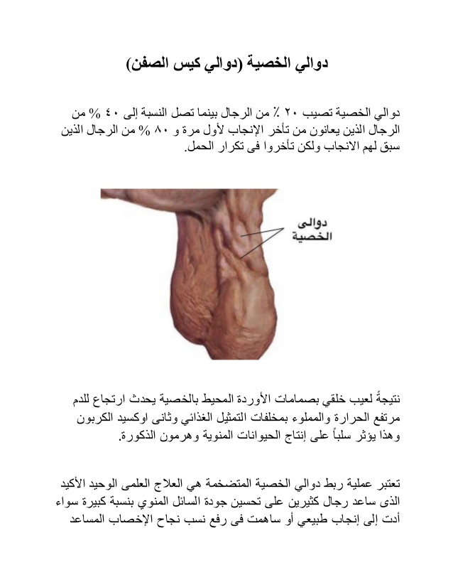 عروق الخصيه الطبيعيه , اسباب انتفاخ عروق الخصية وماذا تدل