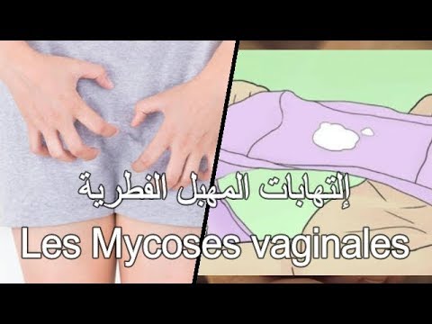 اسباب الرائحه الكريهه في المهبل , اعرفي ازاي تهتمي بمنطقة المهبل