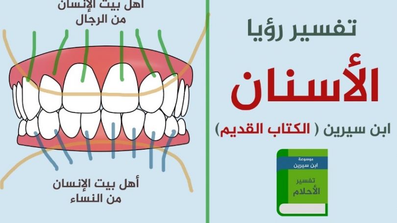 رؤية خلع ضرس - تفسير الحلم بخلع الضرس 1510