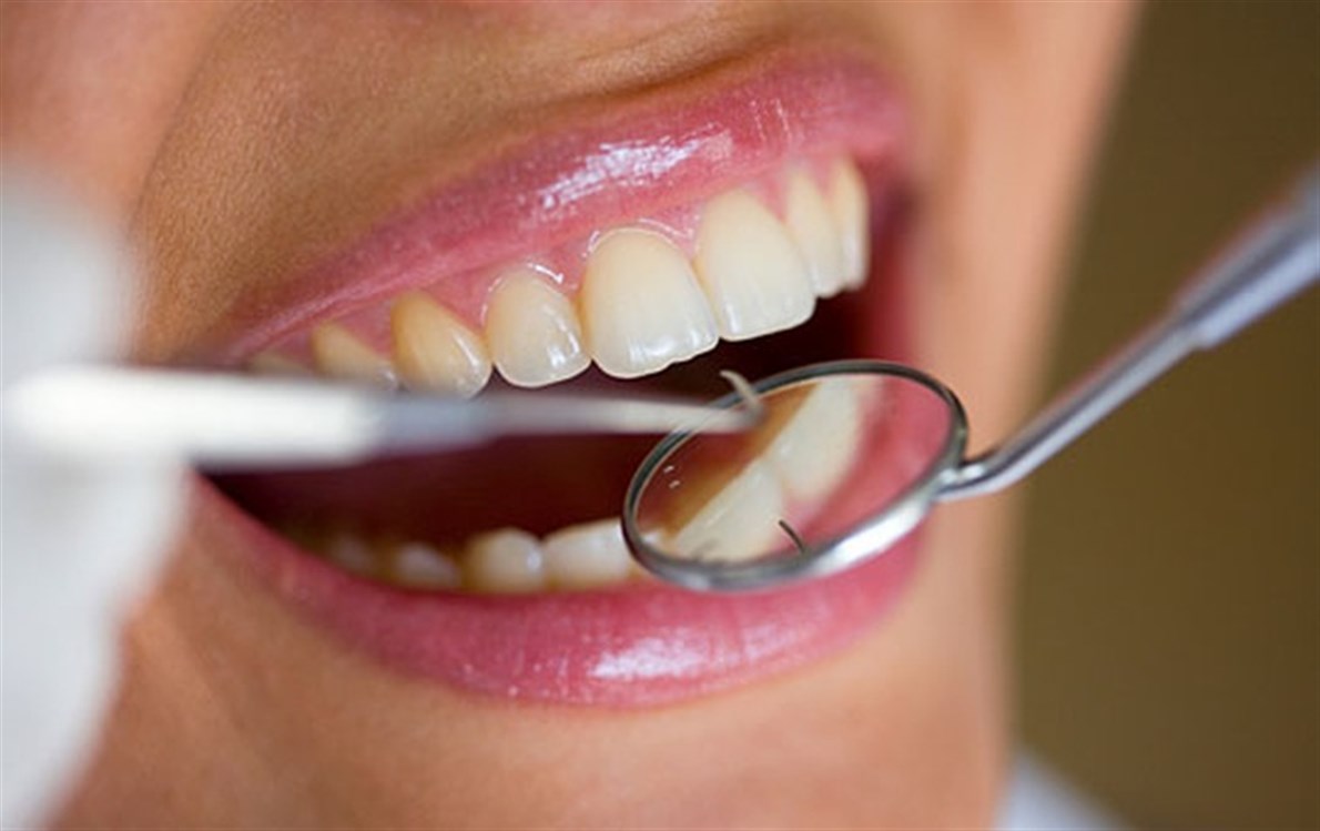 علاج ضعف الاسنان علاج تسوس الاسنان
